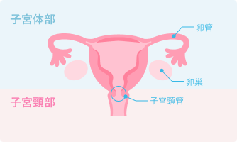 子宮体がん